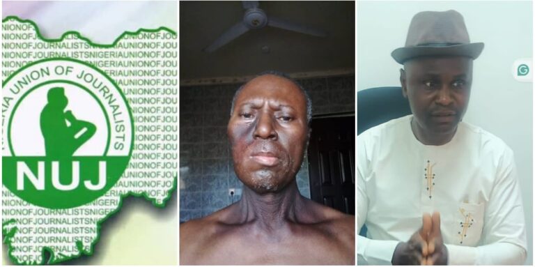 NUJ Appeals to Isoko Sons and Daughters to Save Journalist Battling Cancer
